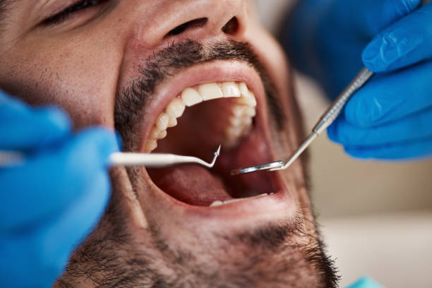 Best Broken Tooth Emergency  in Crump, TN