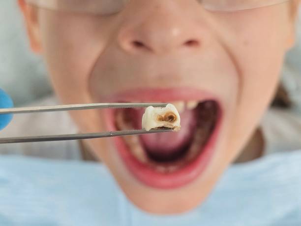 Best Tooth Pain Emergency Relief  in Crump, TN
